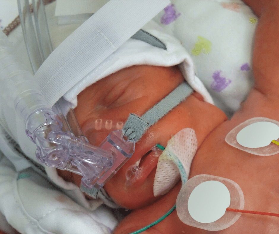 Read more about the article Twin’s Death Resulted in Emergency C-Section