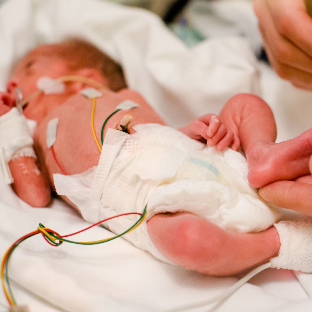 You are currently viewing Birth Mother Bonds With Her Baby in the NICU–Is This Wise?