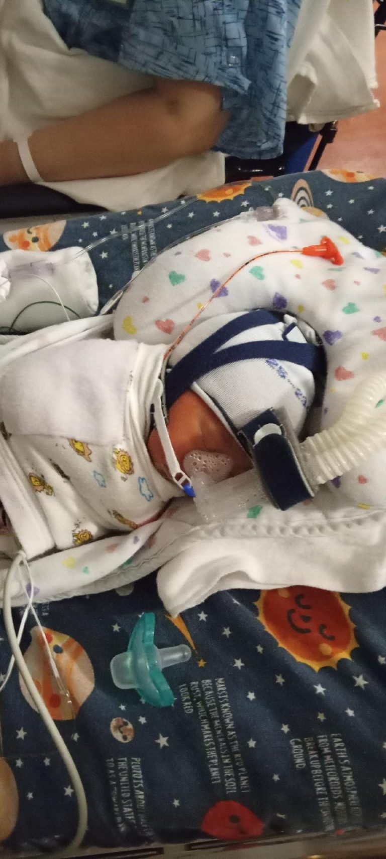 Read more about the article At Last the Parents Get to See His Face–Their Tiny NICU Baby