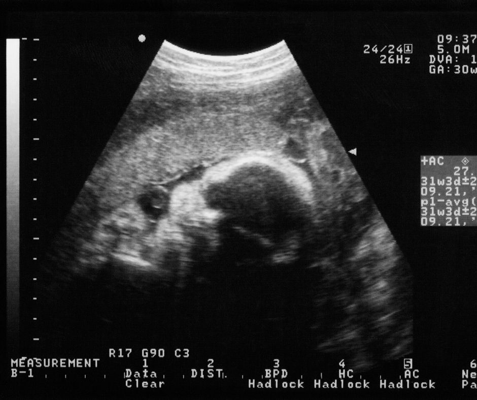 open adoption in Michigan, Michigan Adoption Agency